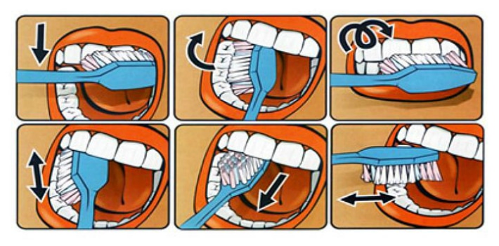 Техника чистки зубов