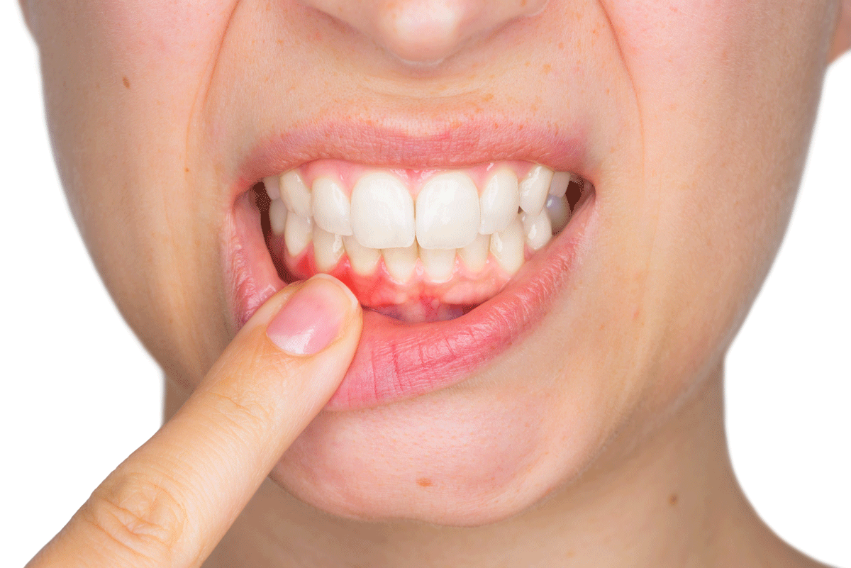 Зубы во рту