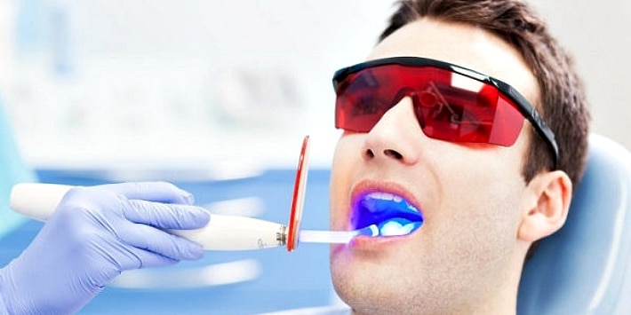  Осветления зубов про помощи лазерного отбеливания