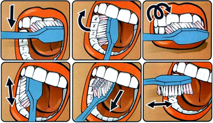  Схема правильной чистки зубов