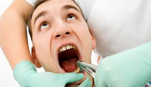 Уход за полостью рта после экстракции