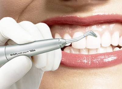Ультразвуковая чистка – безопасный способ снятия зубных отложений