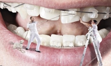 Ортодонтия — наука о правильном приложении силы