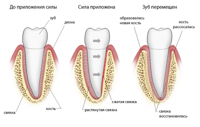 Механизм сдвига зуба в костной ткани челюсти»)