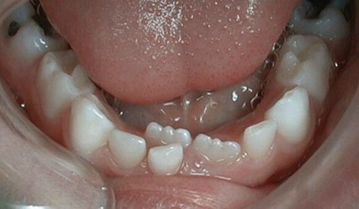 Период смены молочных зубов на постоянные