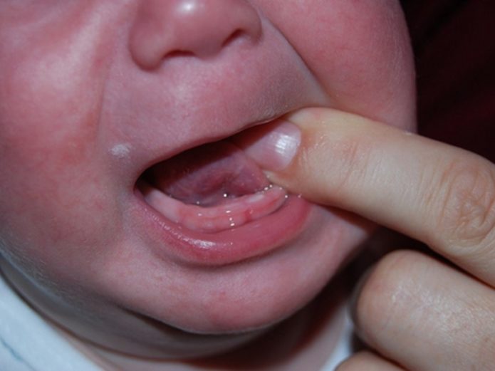 Режутся зубки у ребёнка