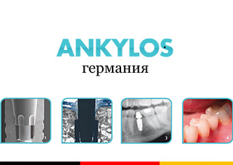 Немецкие импланты Ankylos