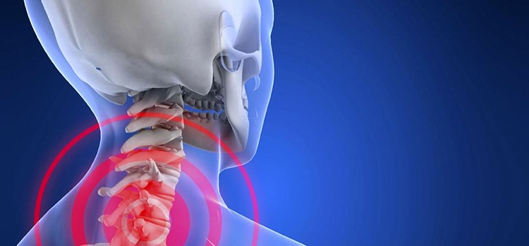 Искривление в шейном отделе позвоночника вызывает сильные головные боли