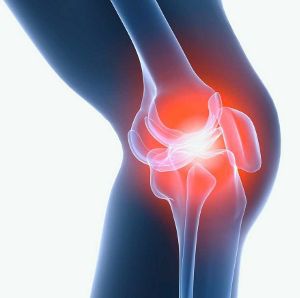 Травма колена требует тщательной диагностики