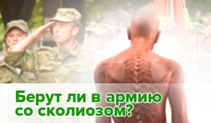 Возьмут ли в армию с остеохондрозом