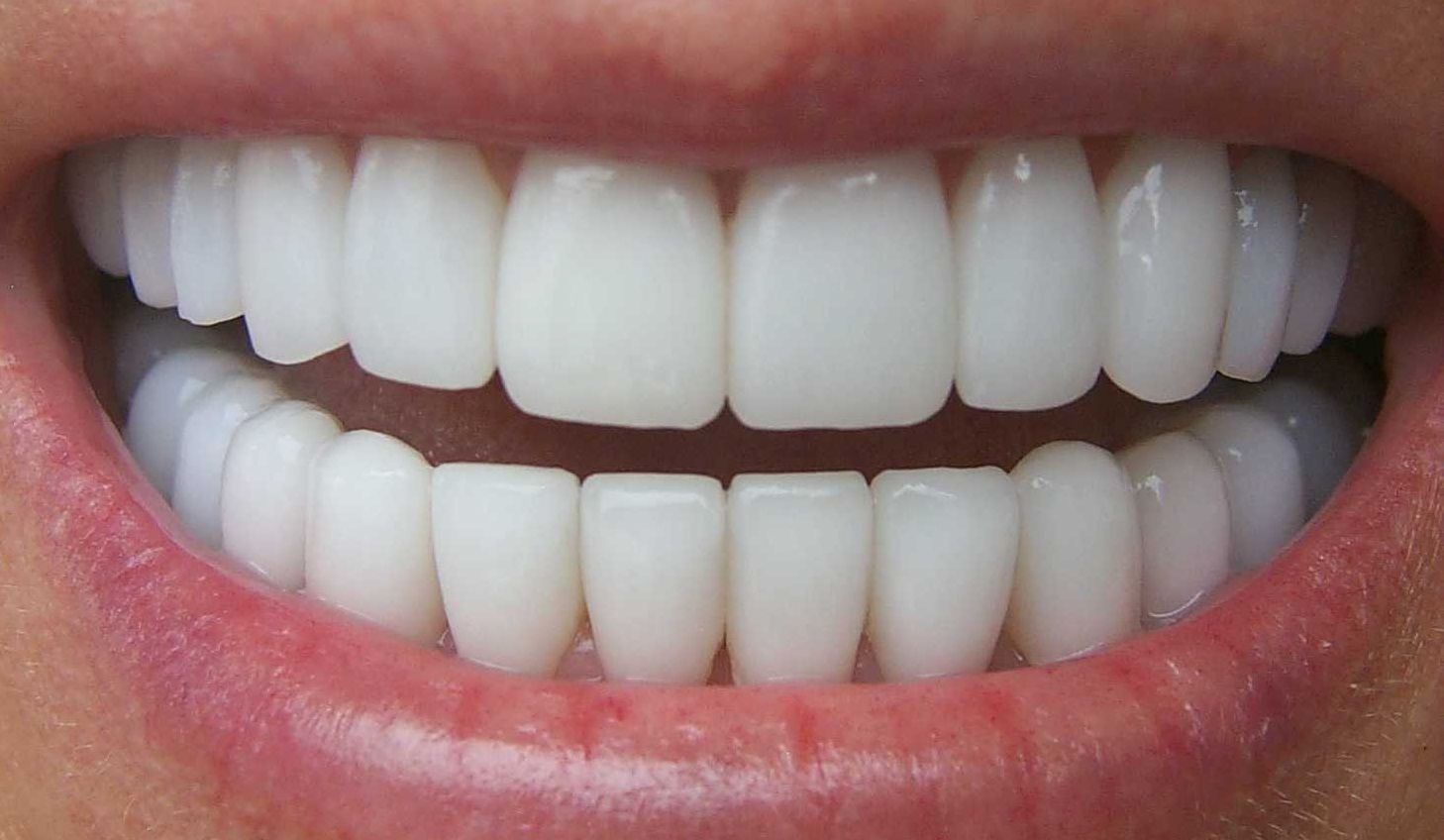 Белизна зубов