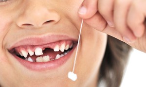 Когда начинают выпадать молочные зубы, необходимо особенно внимательно следить за гигиеной ротовой полости