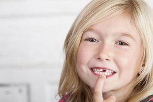 Выпадение молочных зубов - сроки и особенности ухода за зубами