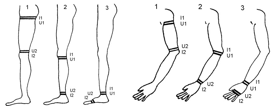схемы расположения электродов при реовазографии рук и ног