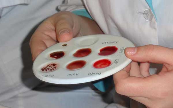 Определение группы крови