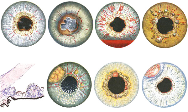 разнообразие форм поражений глаз