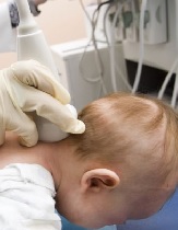 НСГ головного мозга новорожденных